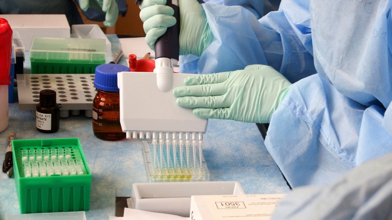 Lab technician adding a solution to an Enzyme-Linked Immunosorbent Assay (ELISA) plate. USA - 2013
