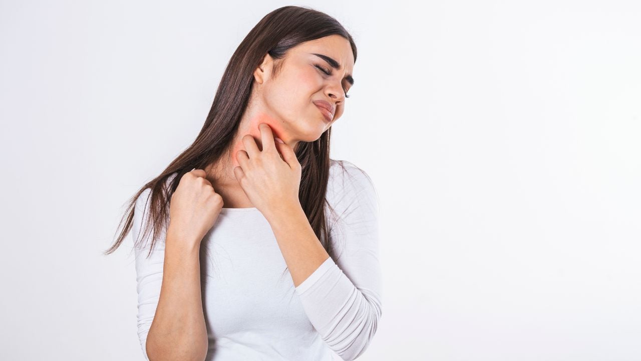 Young woman suffering from itching on her skin and scratching an itchy place. Allergic reaction to insect bites, dermatitis, food, drugs. Health care concept. Allergy rash