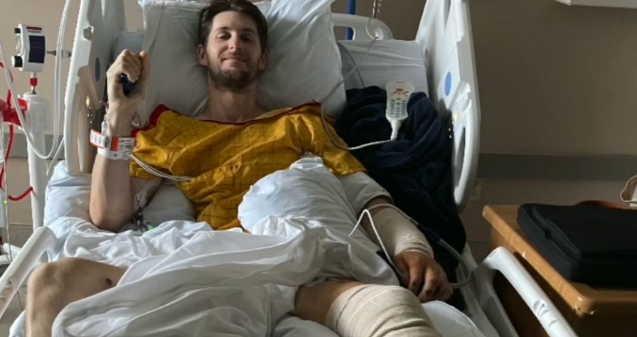 youtuber loses leg in crash