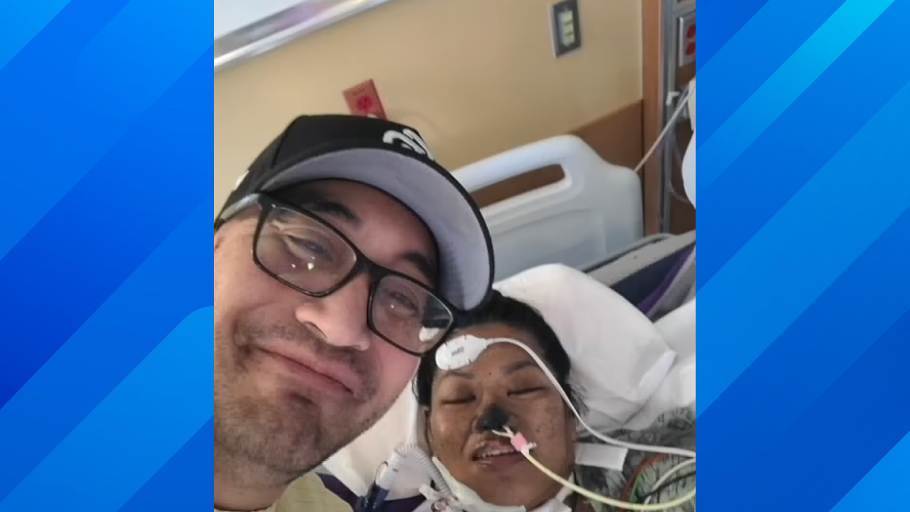 woman loses limbs during surgery