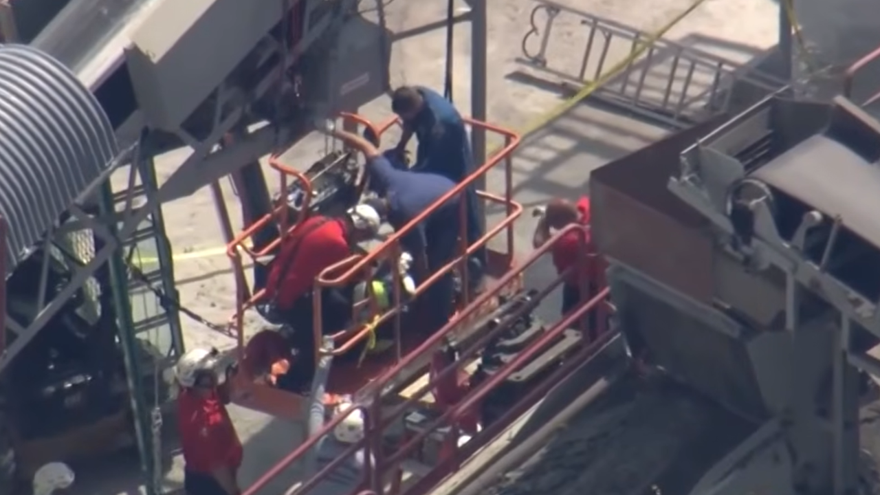 man surgically removed at work