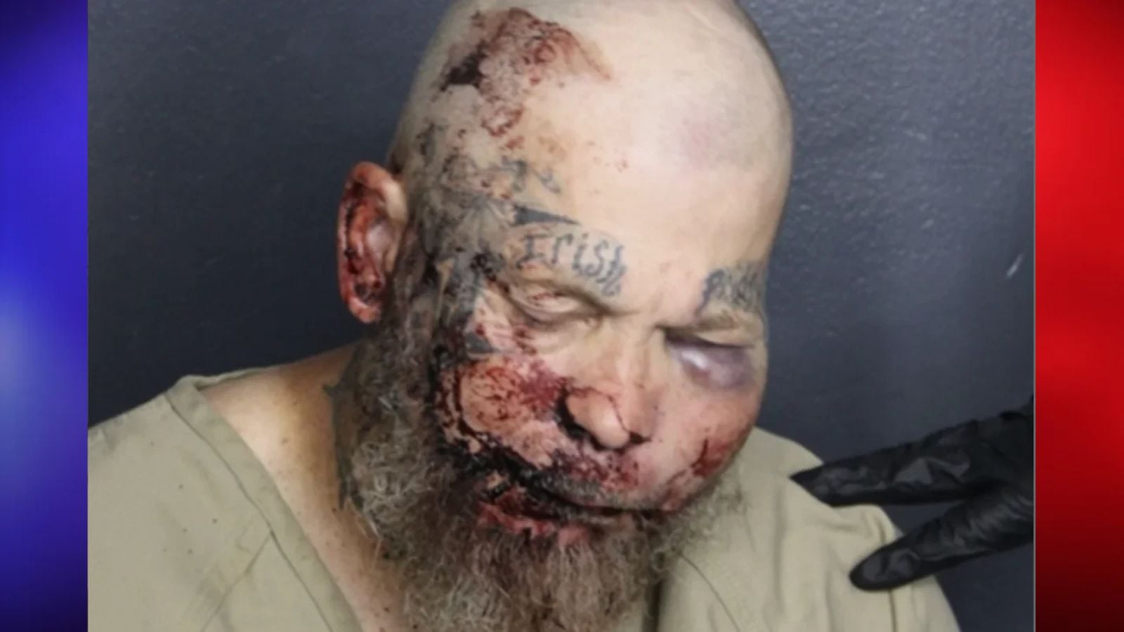Florida Man Tells Cop ‘I Want to Fight You’ at Hospital and Gets His Wish